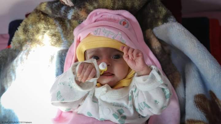 غفران، طفلة يمنية تبلغ من العمر 4 أشهر فقط، لكنها تكافح من أجل البقاء