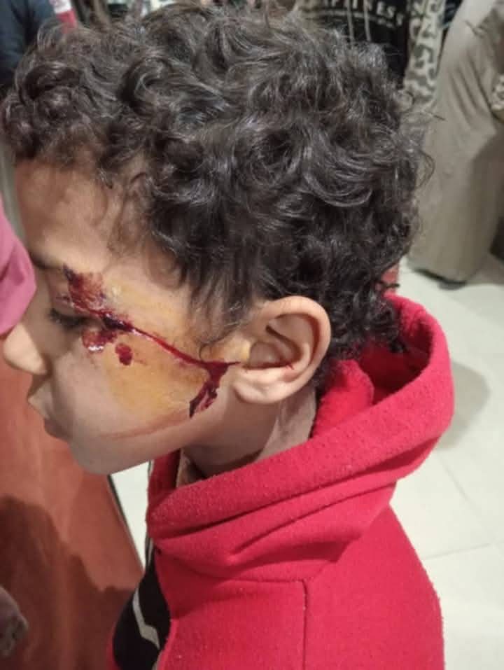ضربة بالموس 