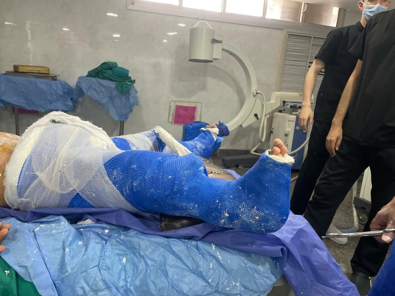 فريق طبي بمستشفى الأطفال بجامعة أسيوط ينجح في إنهاء معاناة طفل يعاني من تشوهات عظمية نادرة ومعقدة 
