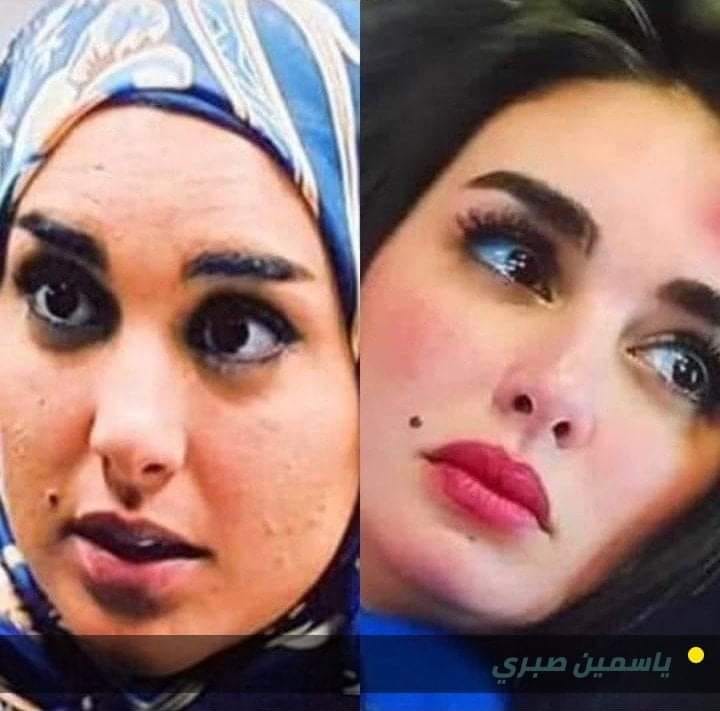 من مايا دياب إلى ياسمين صبري.. كيف شوه “الجمال البلاستيكي” للفنانات حياة الفتيات العربيات؟