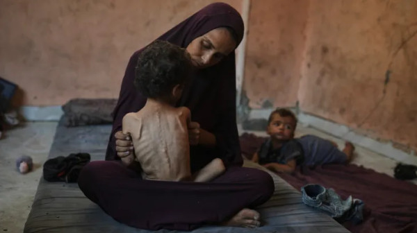 صحة غزة: تسجيل 453 شهيدا بالمجاعة وسوء التغذية