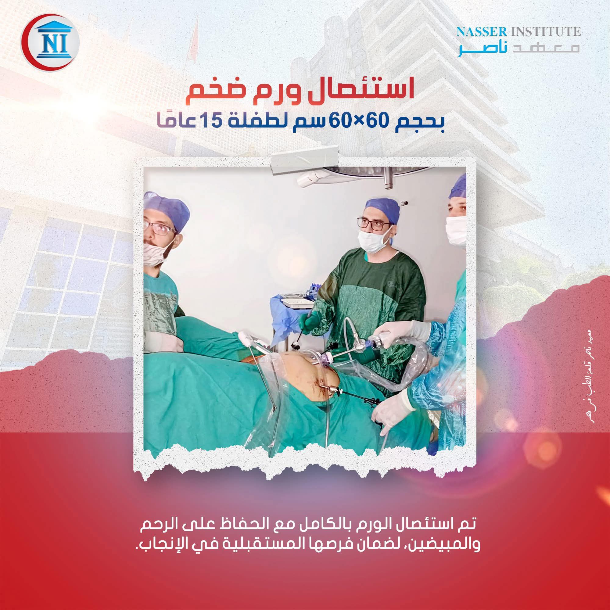 نجاح استئصال ورم ضخم نادر لطفلة 15 عاما بمعهد ناصر