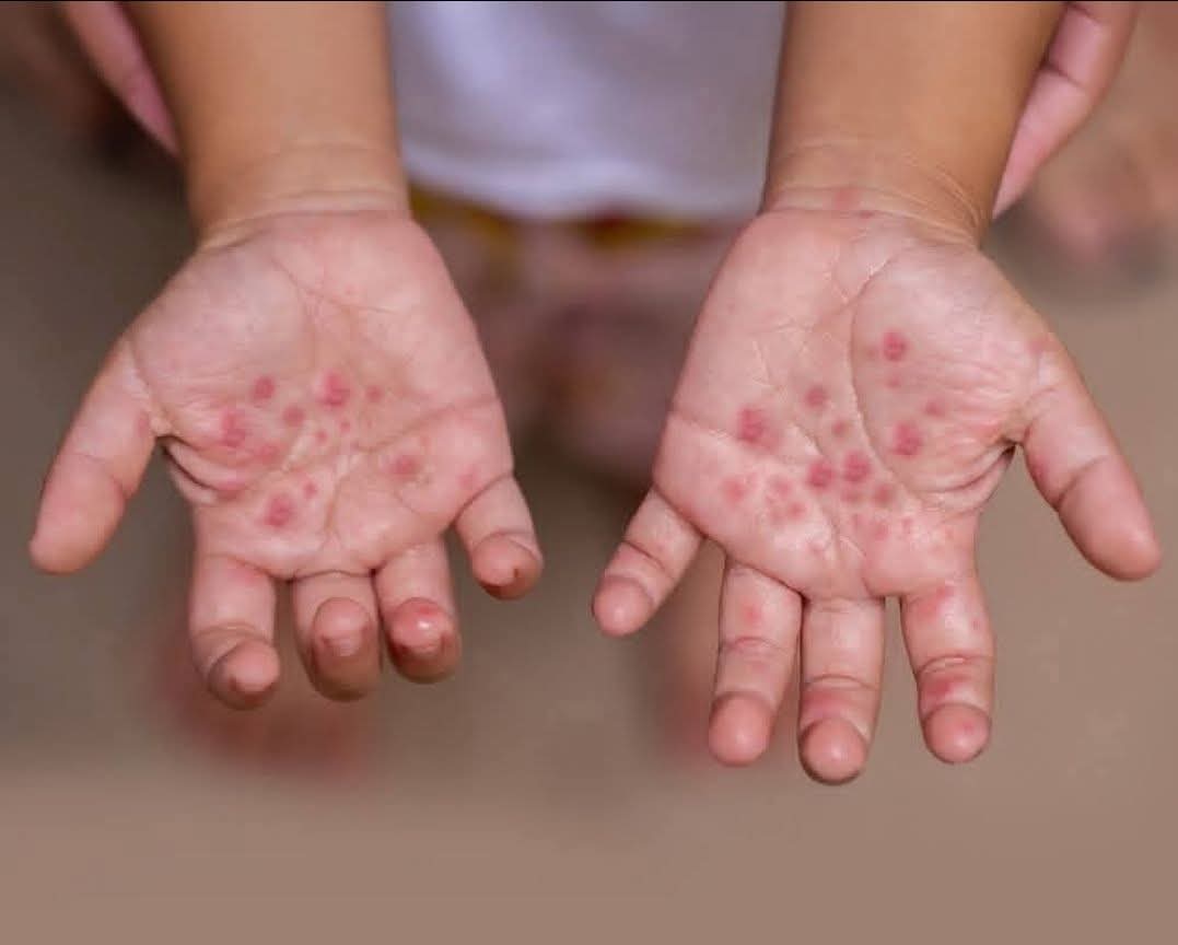 وزارتى الصحة والتربية والتعليم تطمئنا أولياء الأمور