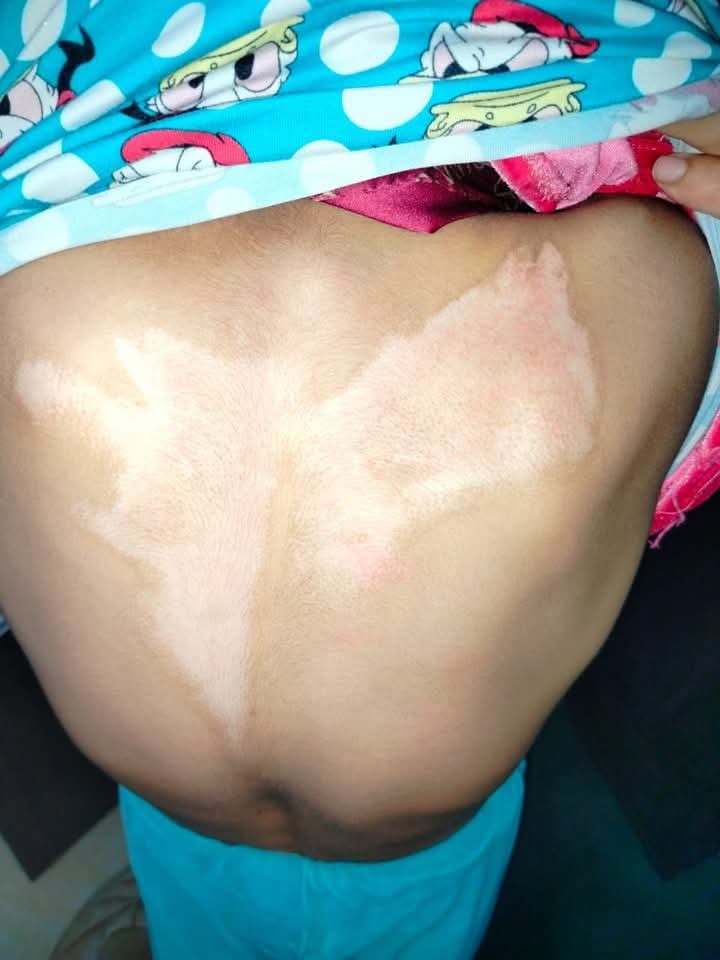 أم تفقد عقلها وتنتقم من زوجها بسكب الماء المغلي علي طفلـتها بالفيوم